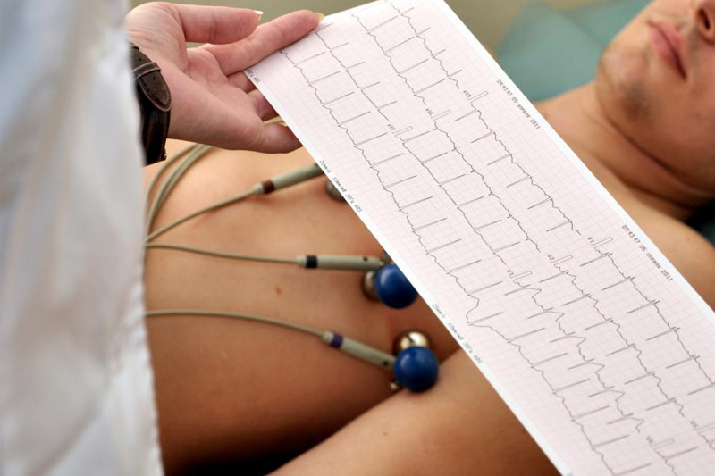 EKG spoczynkowe